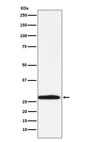 Carbonic Anhydrase 1 antibody western blot K562 STJA0036953
